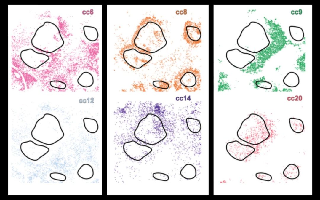 New AI system uncovers hidden cell subtypes, boosts precision medicine
