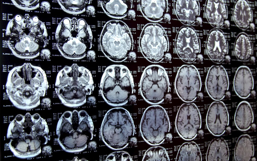 New AI system could accelerate clinical research